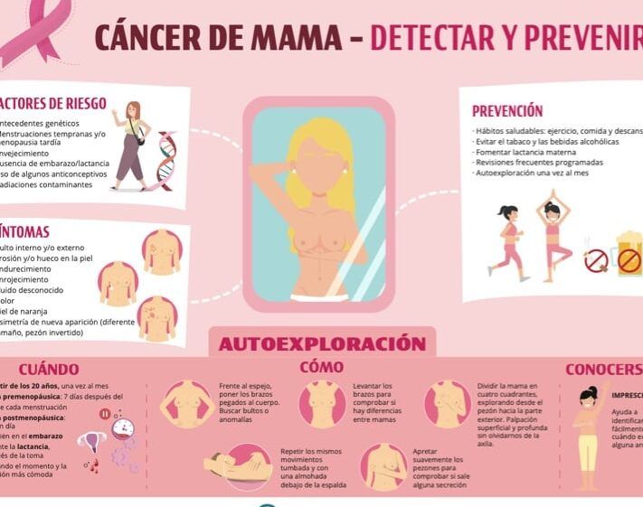 prevencion del cancer de mama